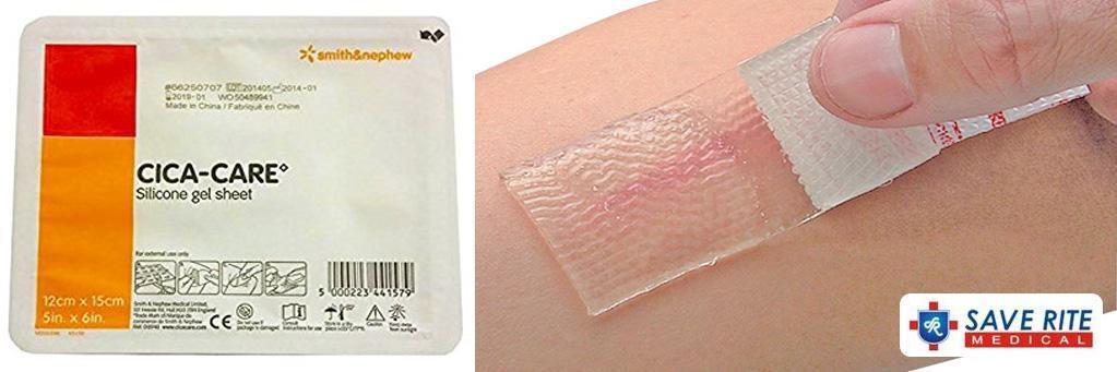 Does Cica Care Silicone Scar Sheets Really Work?