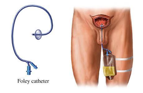 WHAT ARE CATHETERS USED FOR?