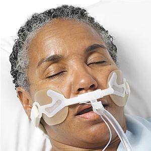 Image of Hollister AnchorFast Oral Endotracheal Tube Fastener 5-10mm