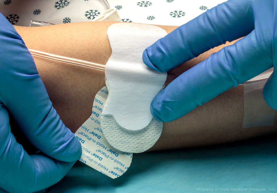 Image of Dale Hold-n-Place® General Purpose Securement Device