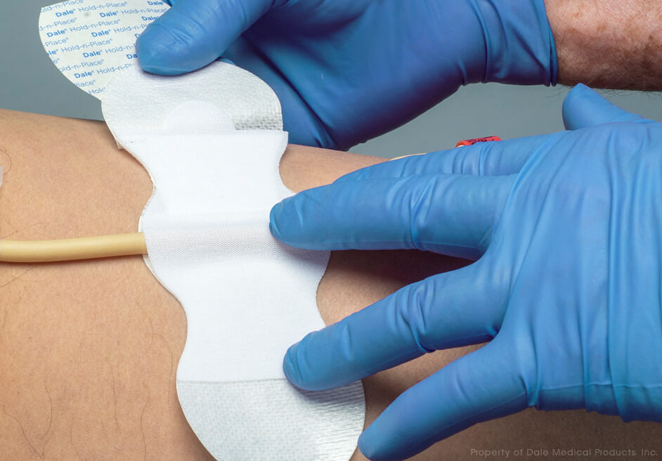 Image of Dale Hold-n-Place® General Purpose Securement Device