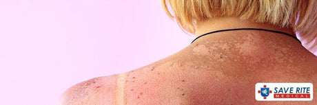Skin Care Tips - Save Rite Medical