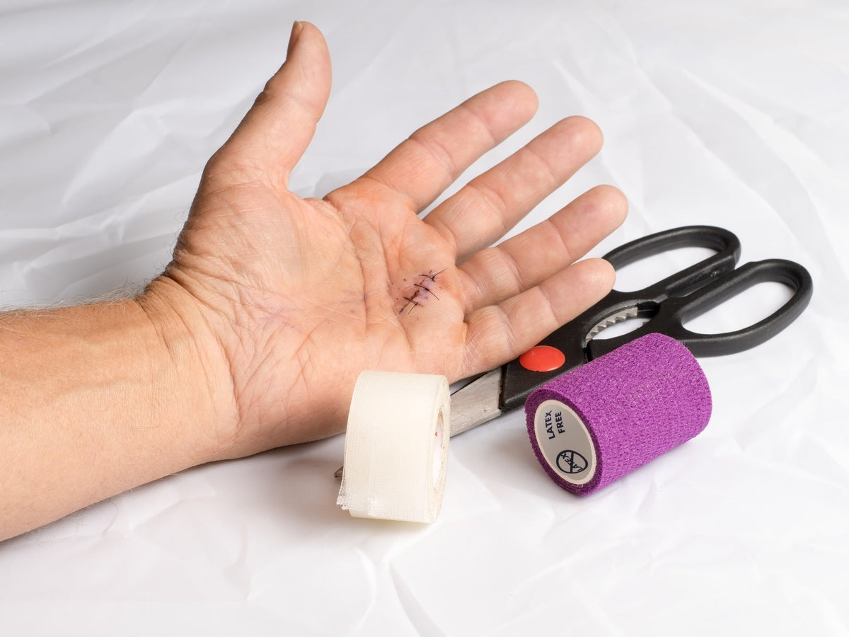 Stitch Rite Do I Need Stitches? Should I use Liquid Stitches? – Save Rite Medical