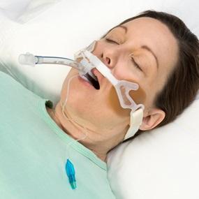Image of Hollister AnchorFast Guard Oral Endotracheal Tube Fastener