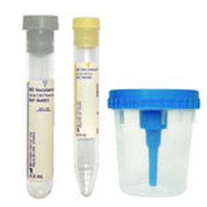 Image of BD Vacutainer Urine Collection Kit with Screw-Cap Cup
