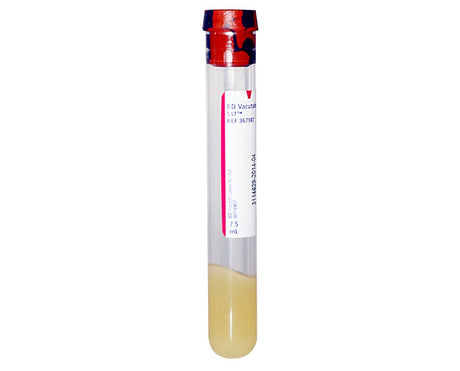 Image of BD Vacutainer® SST™ Tube, 100mm, 16mm OD, 8.5mL Draw Volume