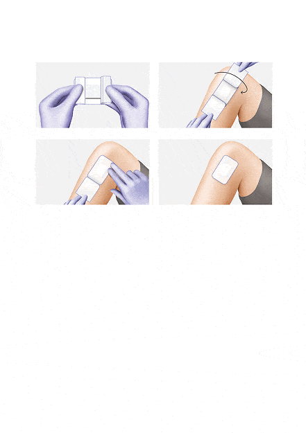 Image of Cosmopor® Steril Adhesive Wound Dressing