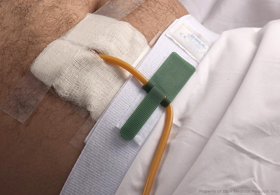 Dale Hold-n-Place® Leg Band Foley Catheter Tube Holder, Leg band/Waist ...