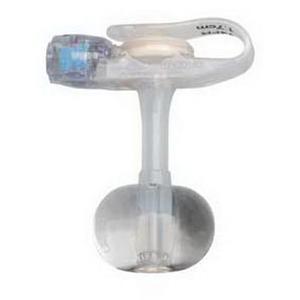 Mini ONE Balloon Button Kit 14 fr x 2-2/7 cm – Save Rite Medical