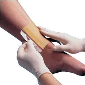 Image of Replicare Hydrocolloid Dressing, 6" x 6"